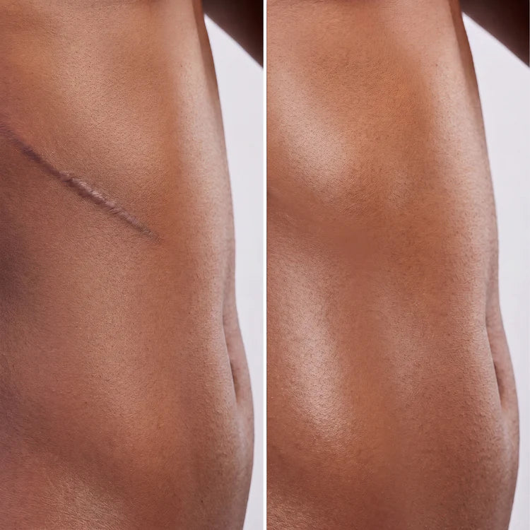 Scars & Blemishes