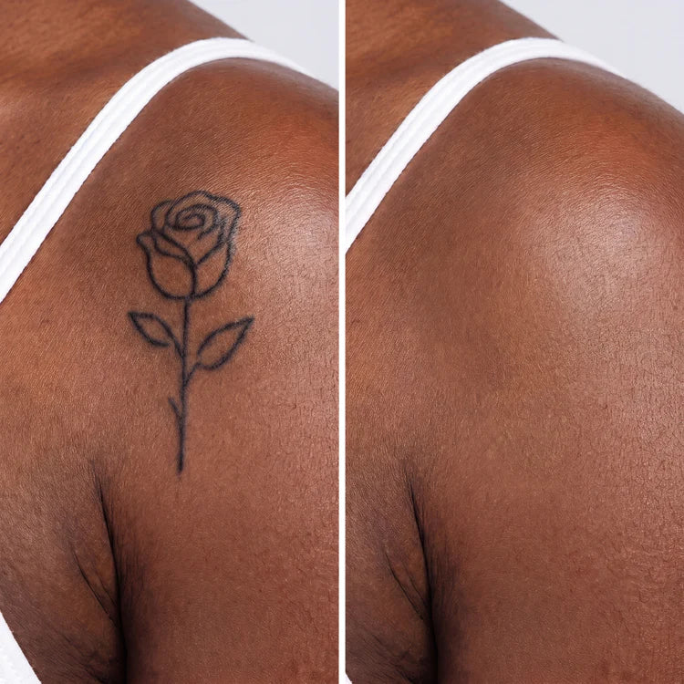 Tattoo Coverage